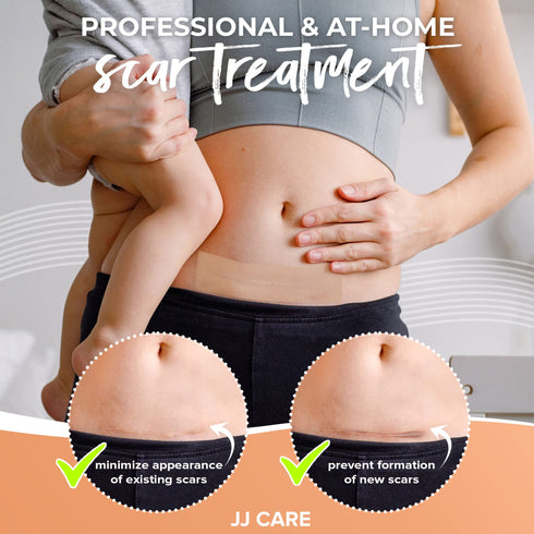 JJ CARE Soft Silicone Tape, 1.6” x 60” Flexible Silicone Scar Tape, Medical Grade Silicone Strips for Scars, Washable & Reusable Scar Tape for Surgical Scars, Latex-Free Scar Tape